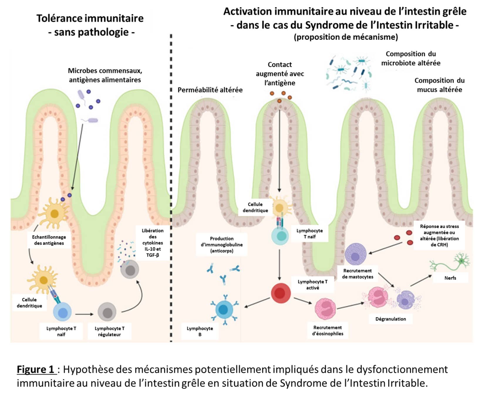 Syndrome De Lintestin Irritable Et Immunit Cerin