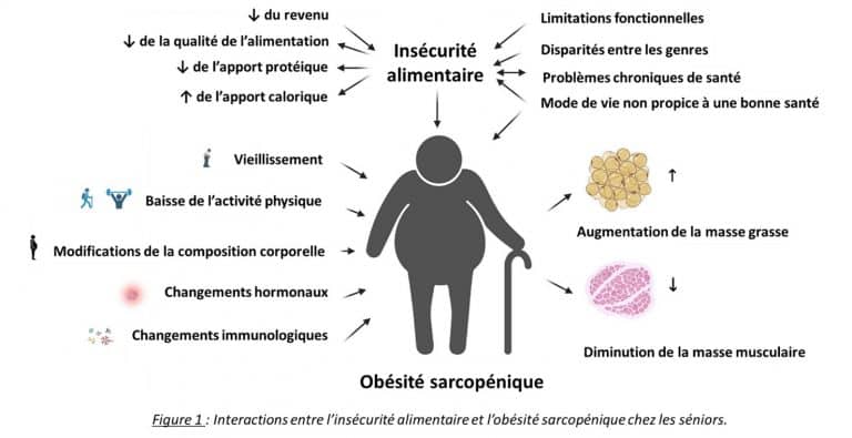 Insécurité alimentaire chez les séniors et obésité sarcopénique Cerin